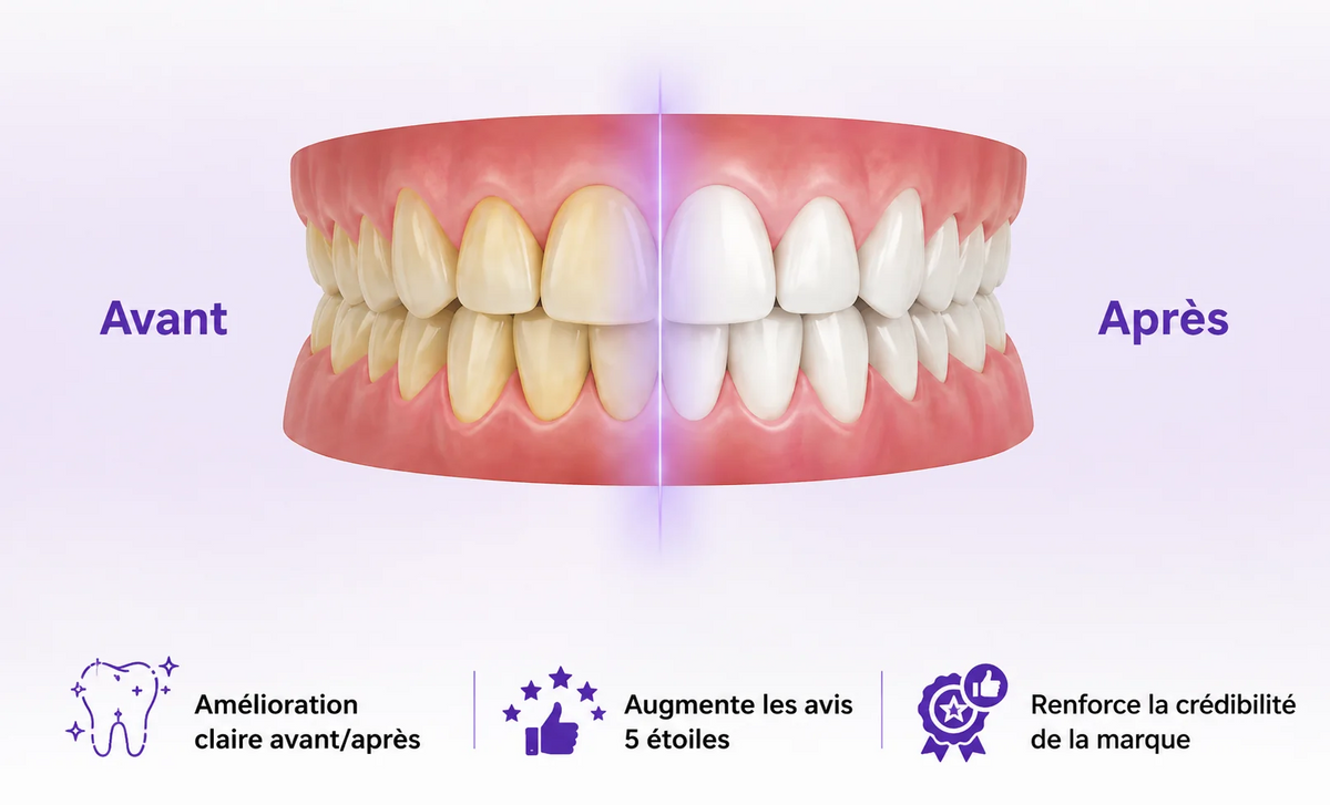 Celneo® - Bandes Blanchissantes Violettes
