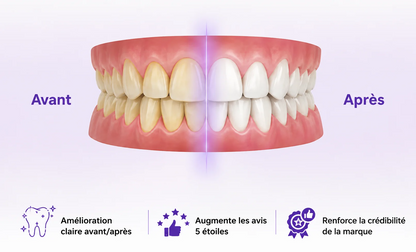 Celneo® - Bandes Blanchissantes Violettes